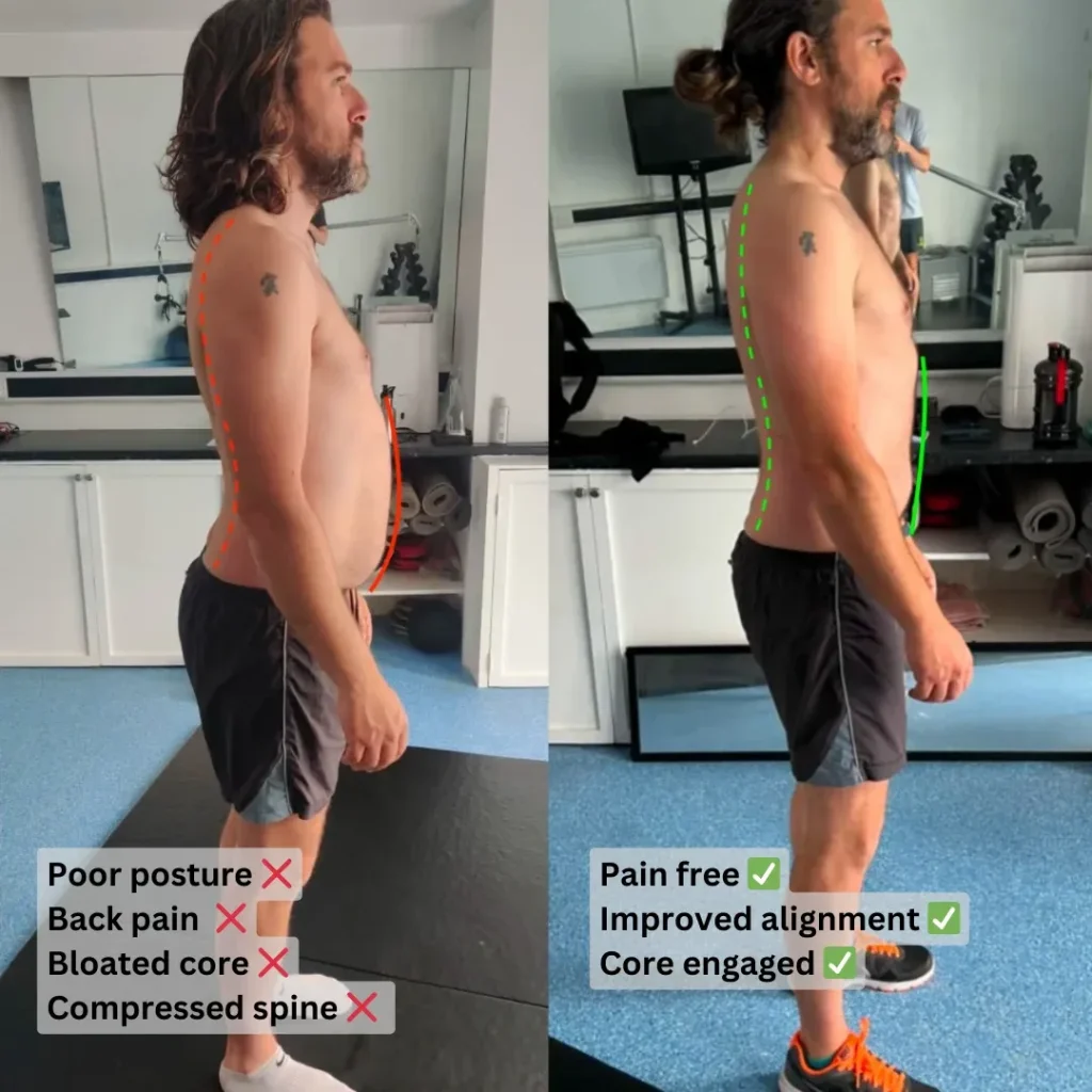 Patient receiving back pain treatment at Bristol Biomechanics clinic