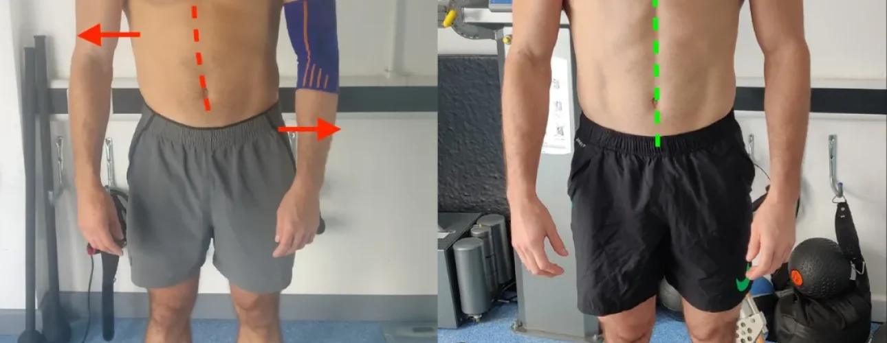 Bristol Biomechanics specialist Josh providing movement assessment support